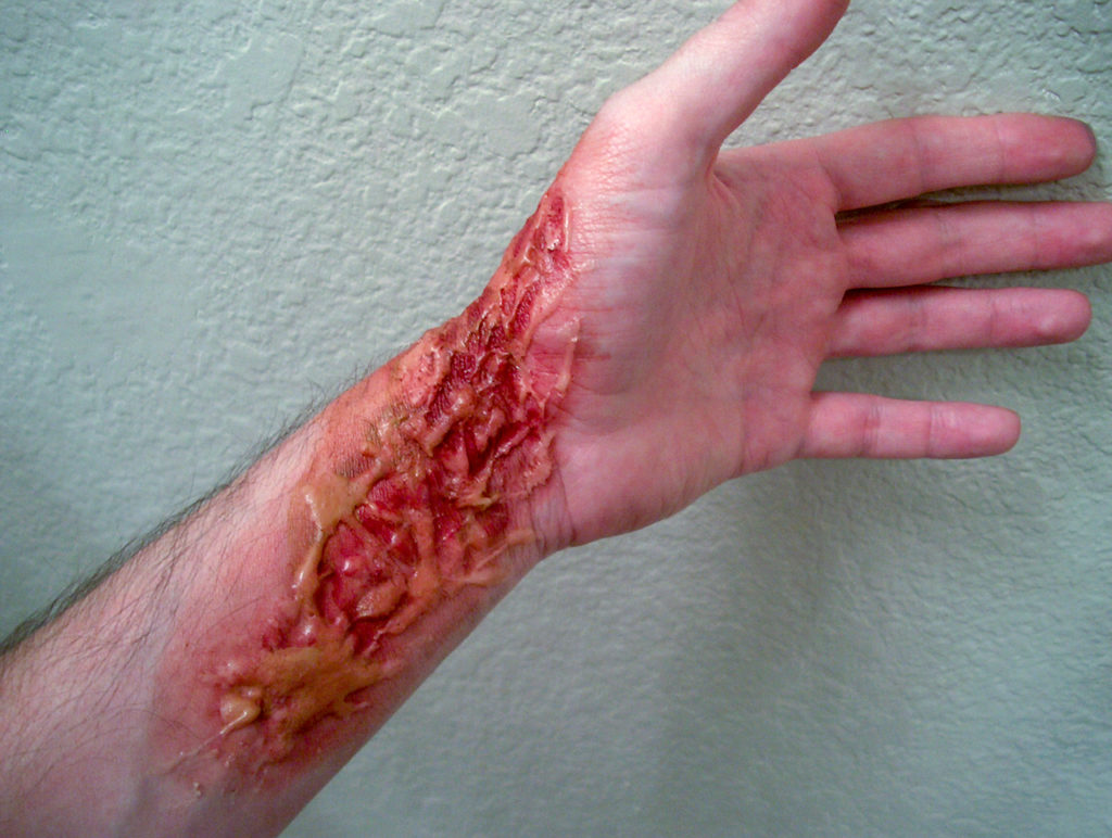 Gelatine Arm Wound Makeup